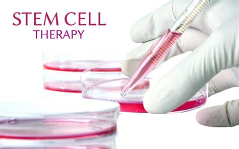 stem cell therapy wayne nj